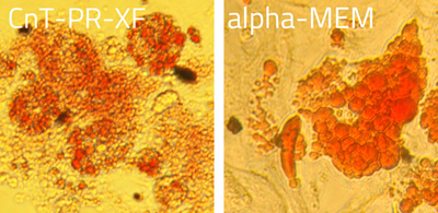 Adipogenesis MSC-XF